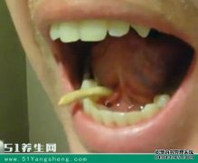 唾液是什么原因引起的？